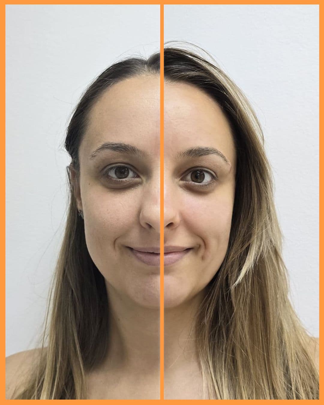 Kozmetički tretmani za podmlađivanje kože